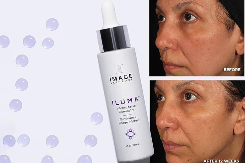 Tác dụng serum trị nám trắng da Image Iluma Intense Facial Illuminator 30ml